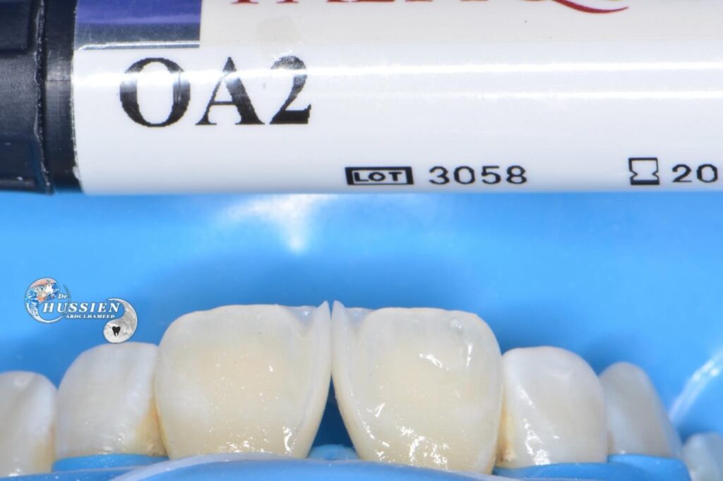 F5E71770-F839-4C9F-AF5F-B8A4F81CEA4F