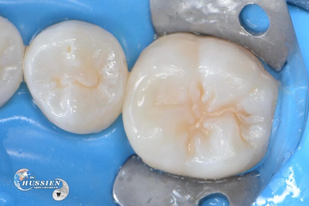 FBDA41EE-5194-45B7-8B1E-ADC09DB8E813