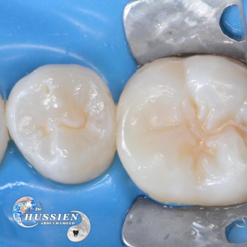 FEB501D2-3E80-4948-84D3-12D2B473E8D5