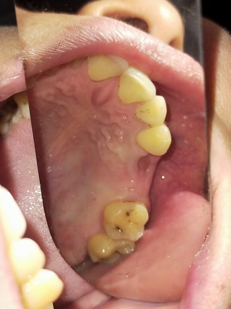 Pre operative