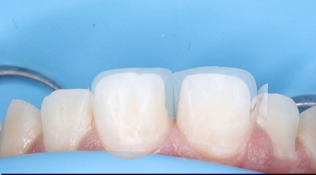 inbound1008413518113388395