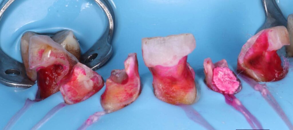 inbound1172731170379684051