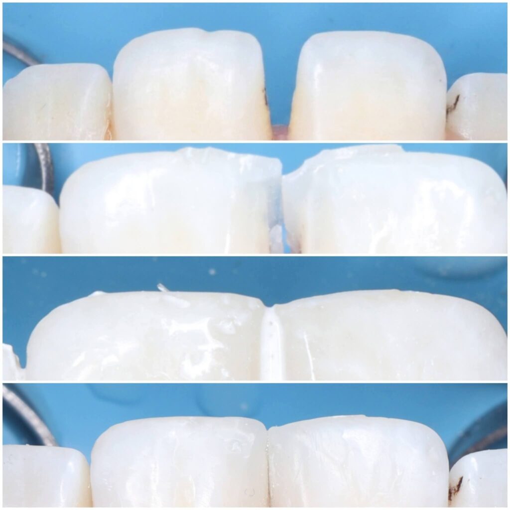 inbound198027276305644937