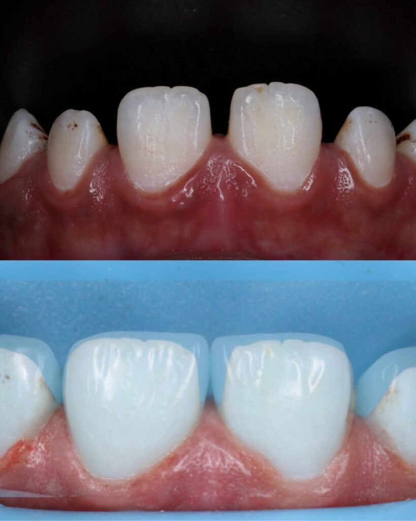 inbound236628919359118048