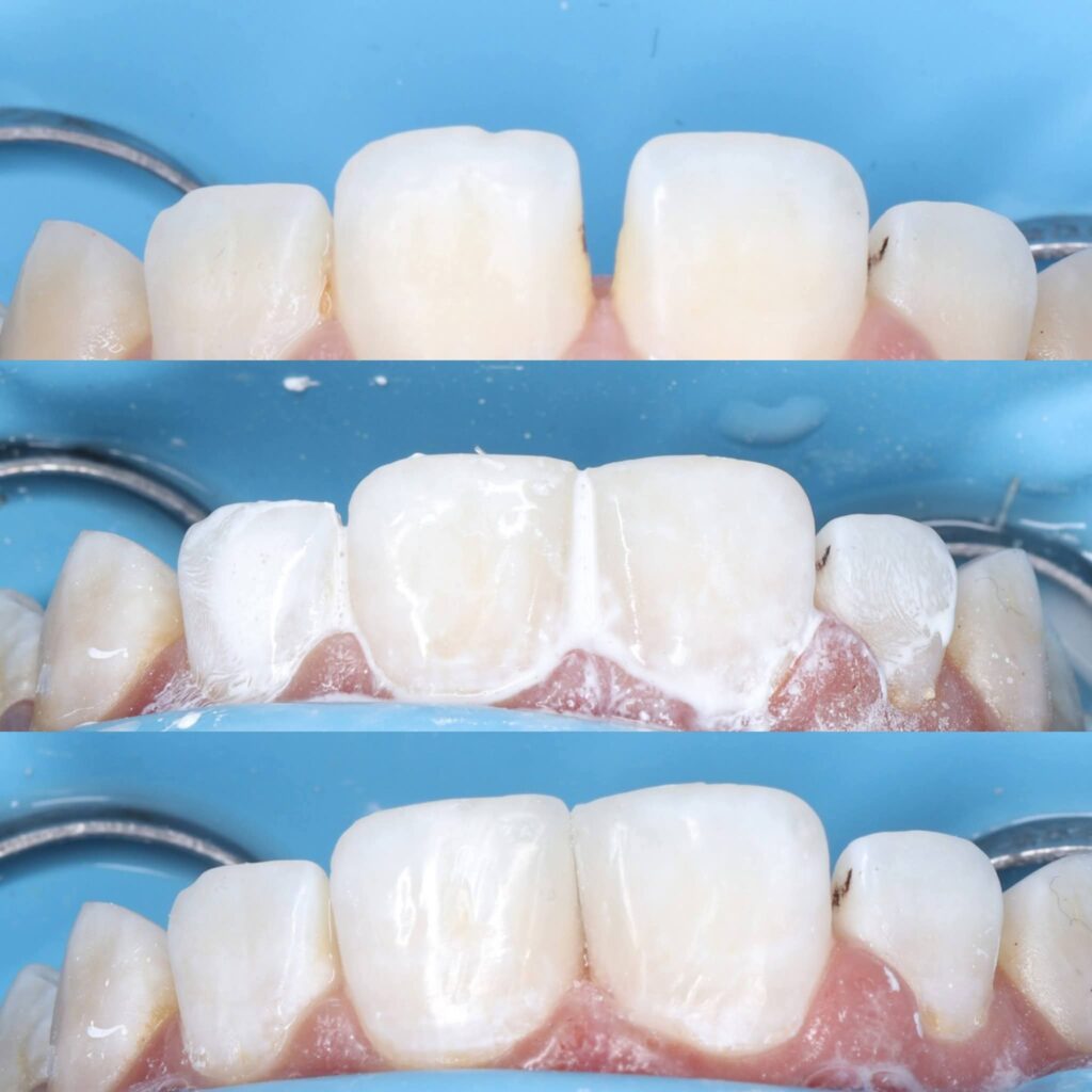 inbound2593836372108096829