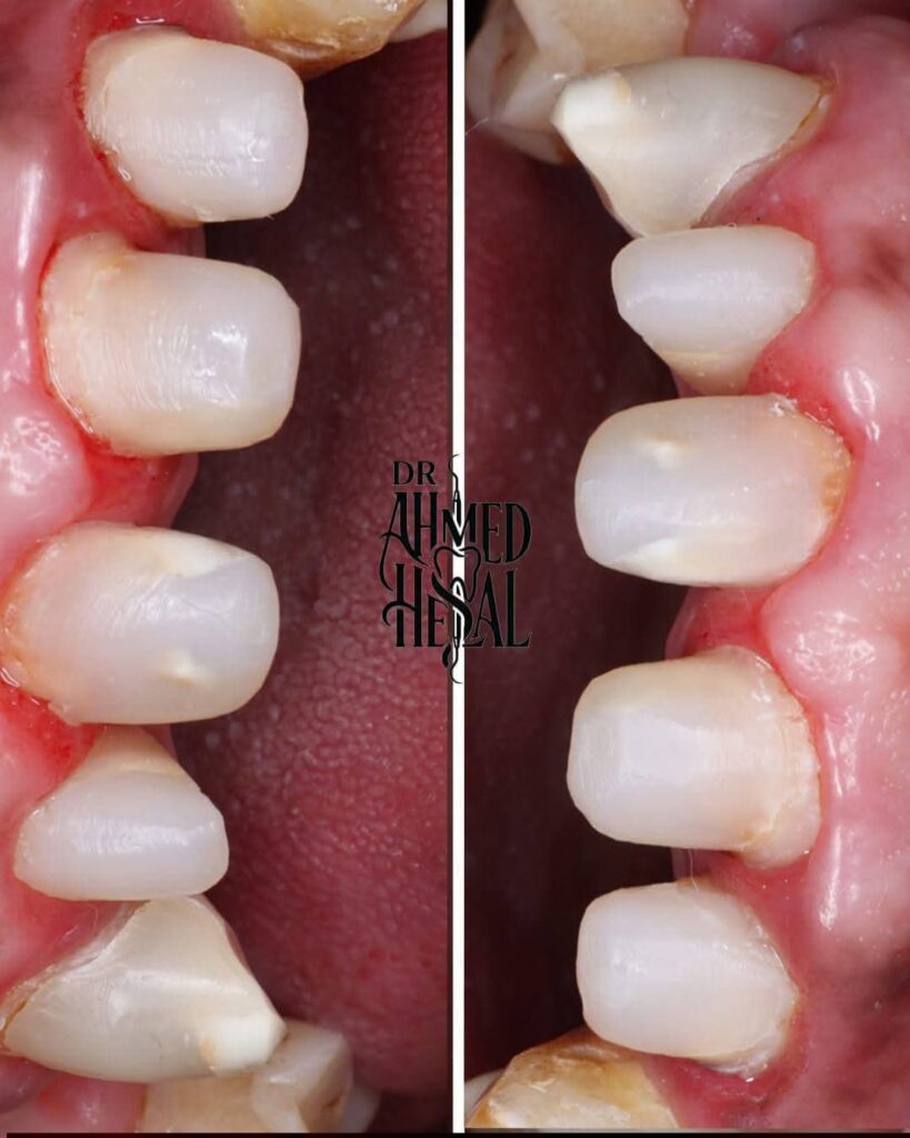 inbound29000661179063334