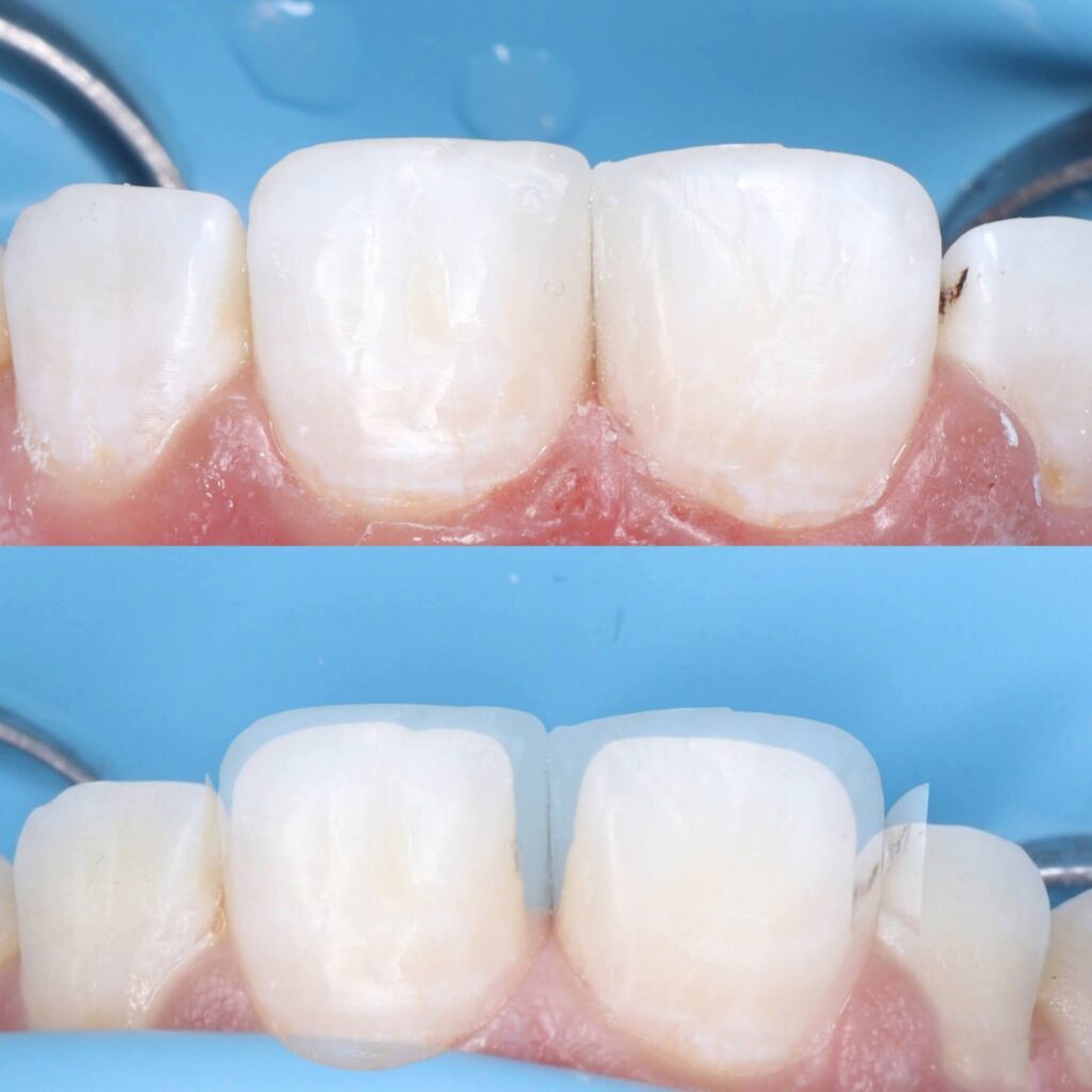 inbound3392618226017999743