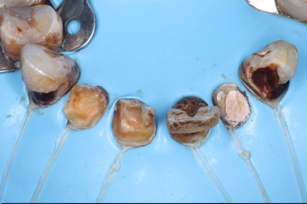 inbound3558282022900745292