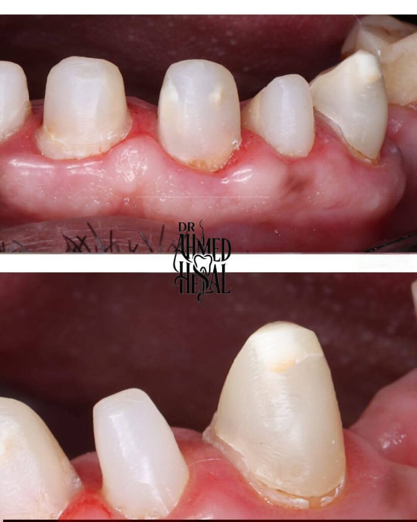 inbound3787323842132040110