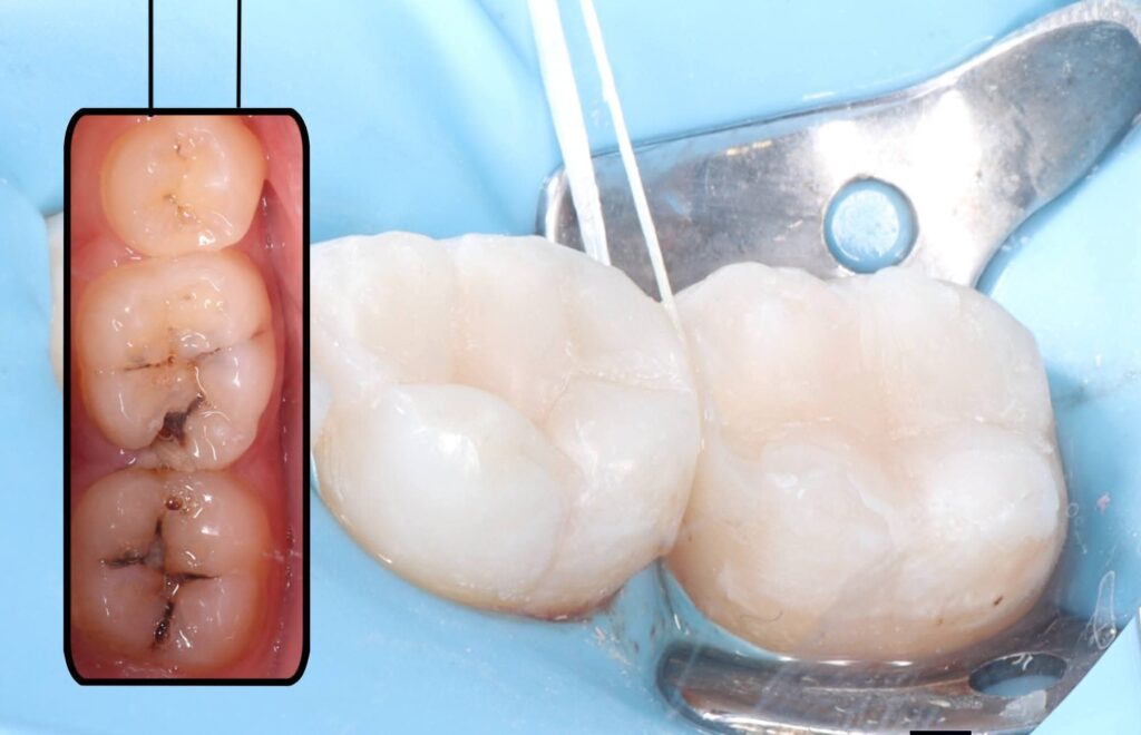 inbound3900434402239158777