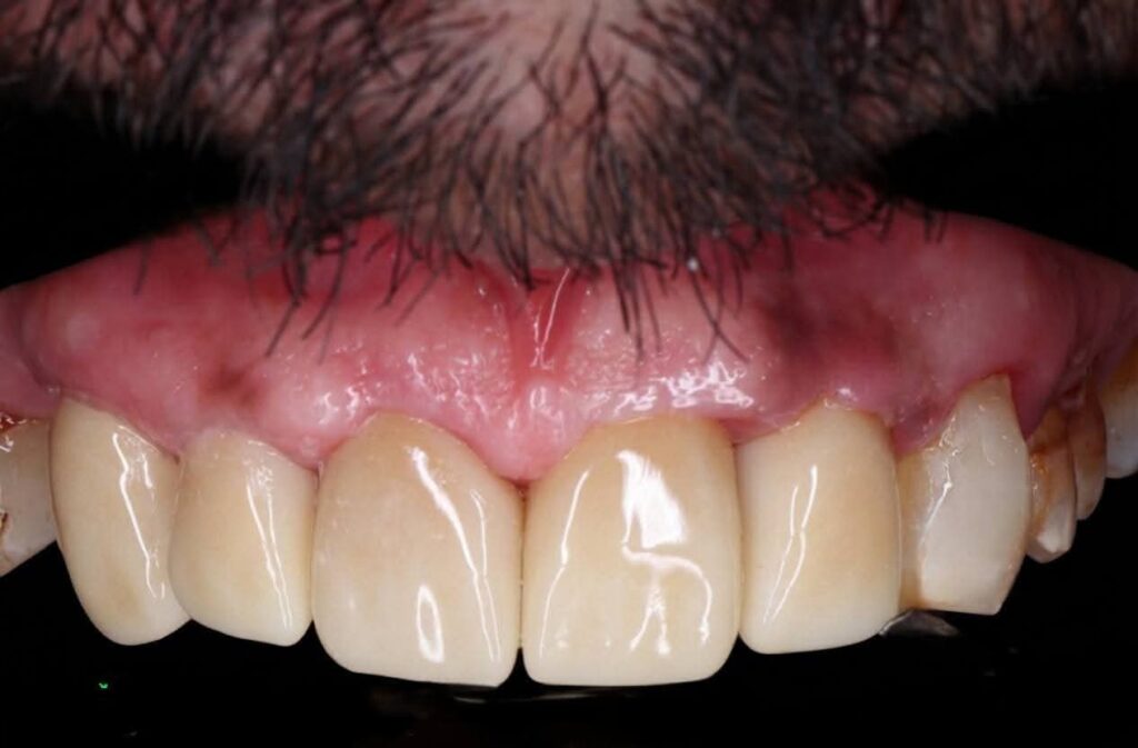 inbound4620106464378777900