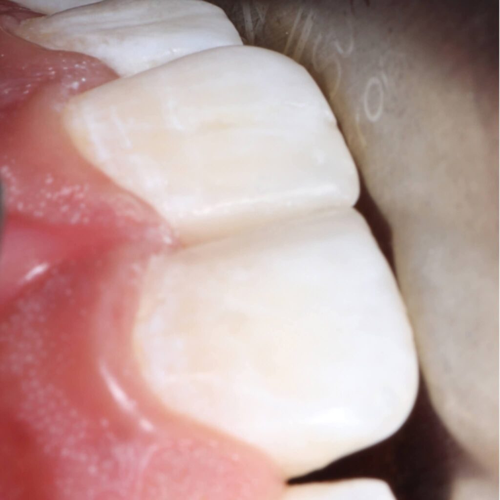 inbound4734491563356964483