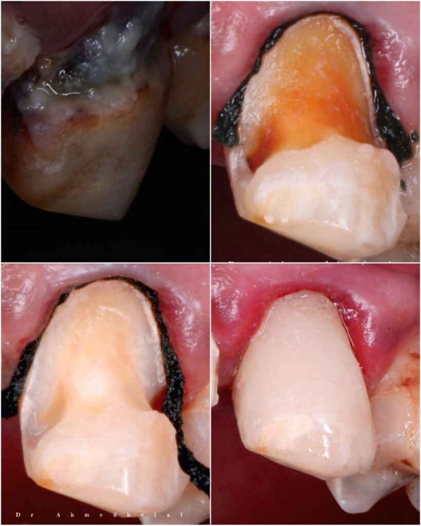 inbound4835214098047501359