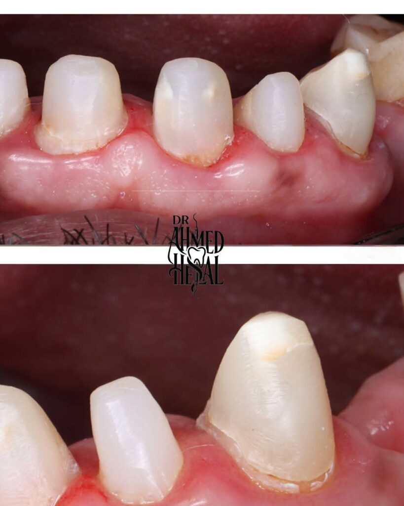 inbound5039383163876548522