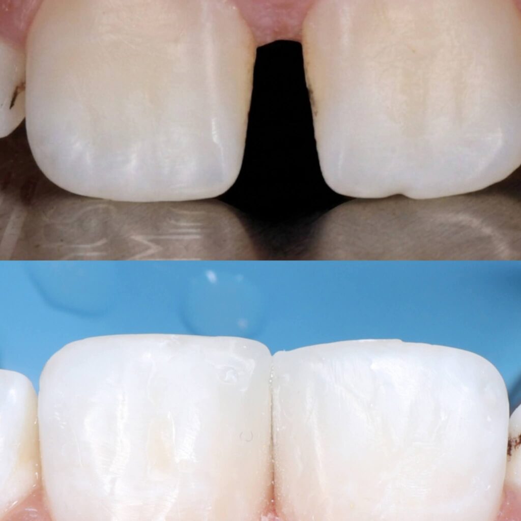 inbound5442380073294267745