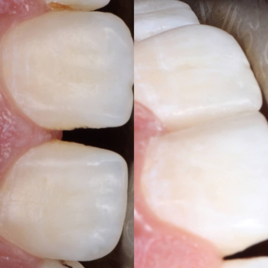 inbound5606343011965225139