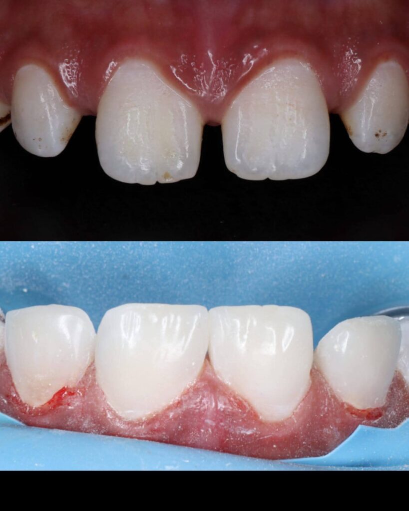 inbound564716311523302457