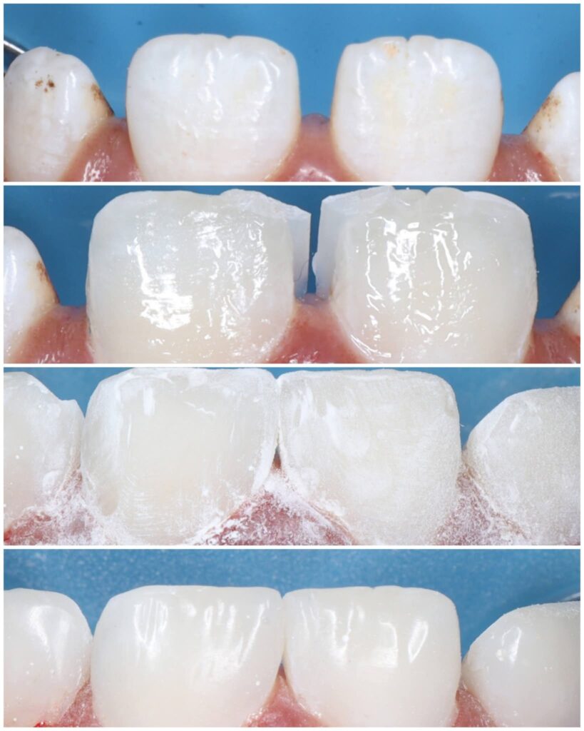 inbound5664114836153459441