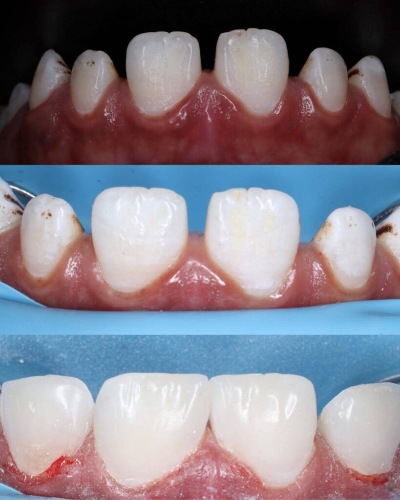 inbound5749221636761922390