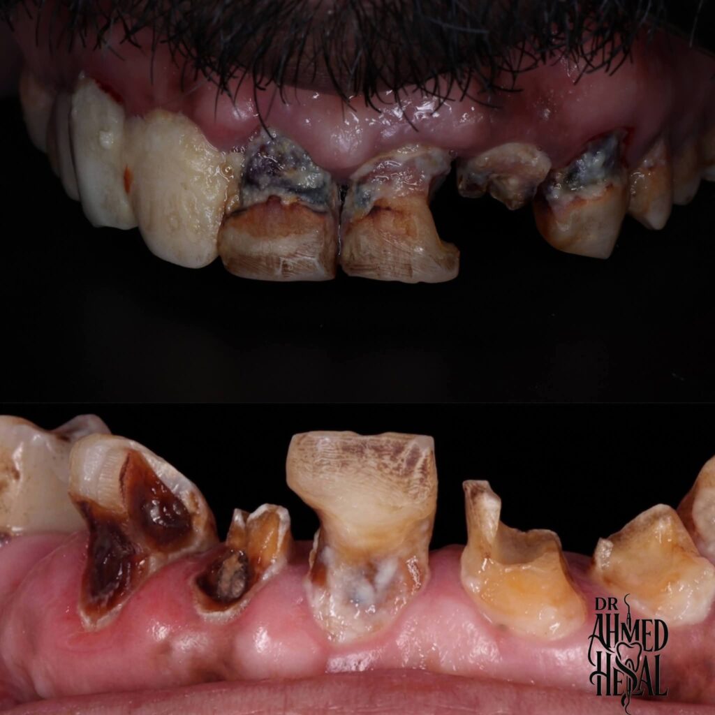 inbound6176522908810438288