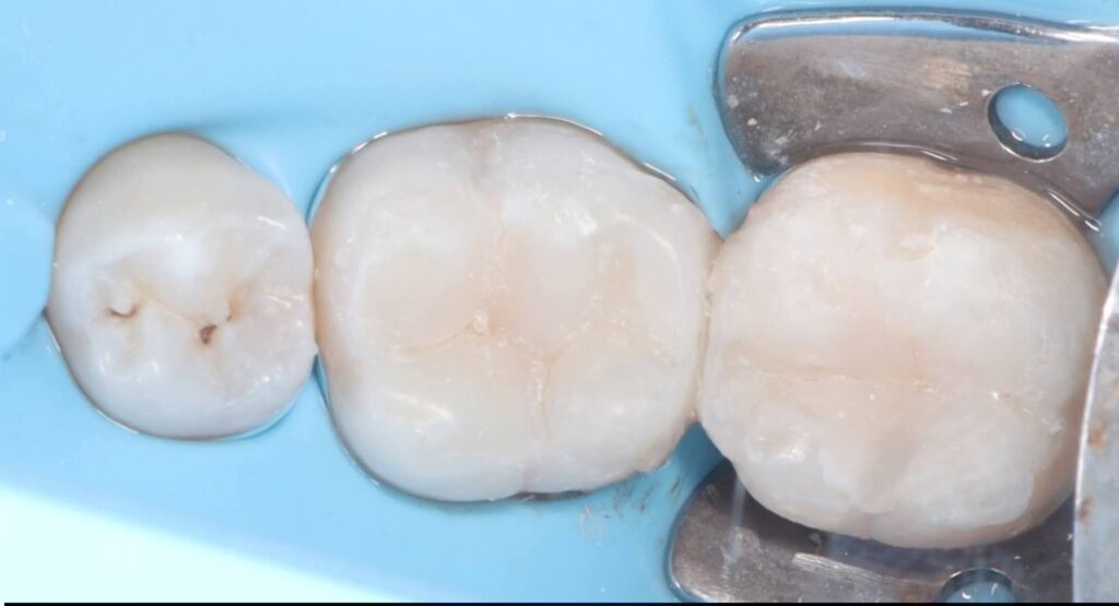 inbound6247690195306404477