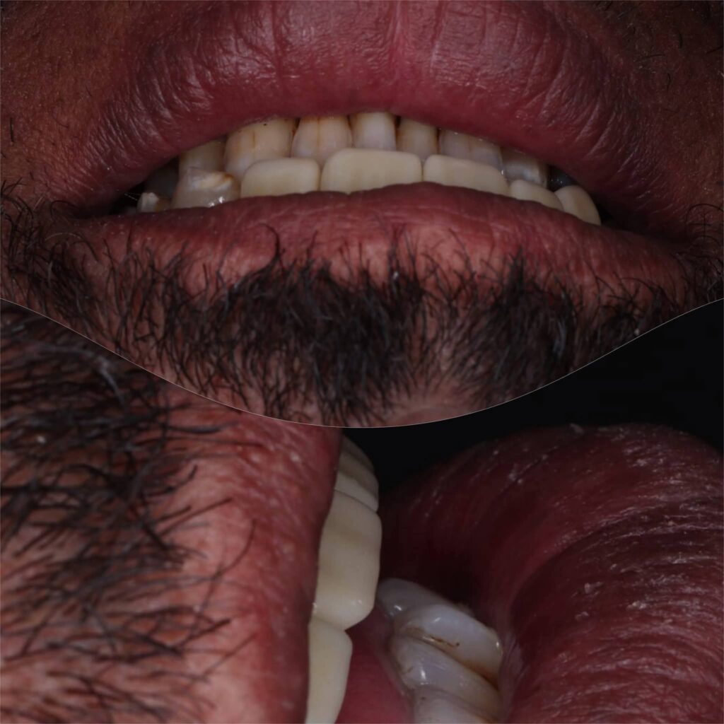 inbound651472742298310456