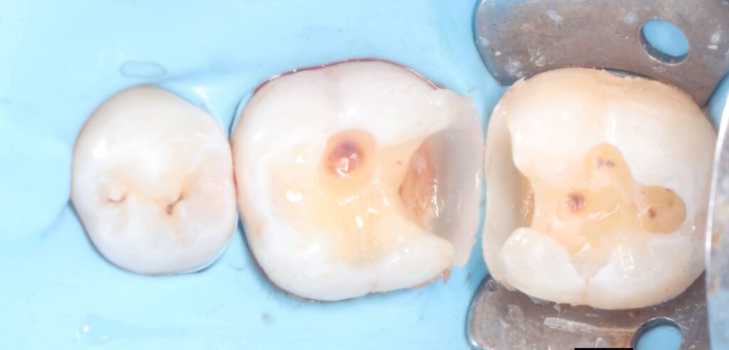 inbound7037555126965280263