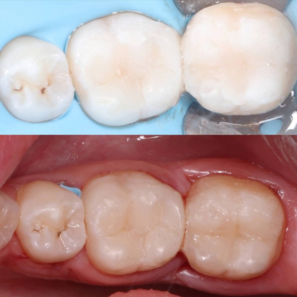 inbound7594876482005445925