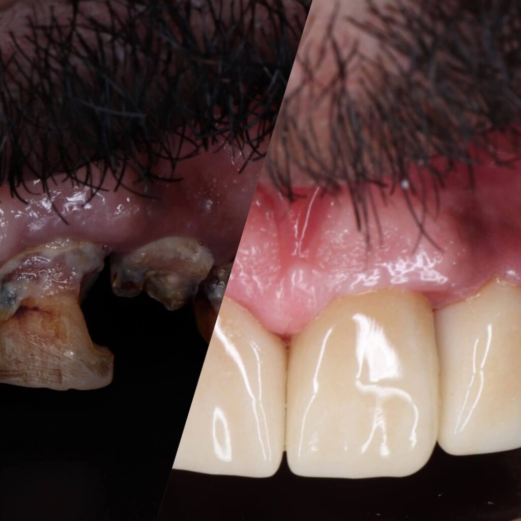 inbound9027359222607818087