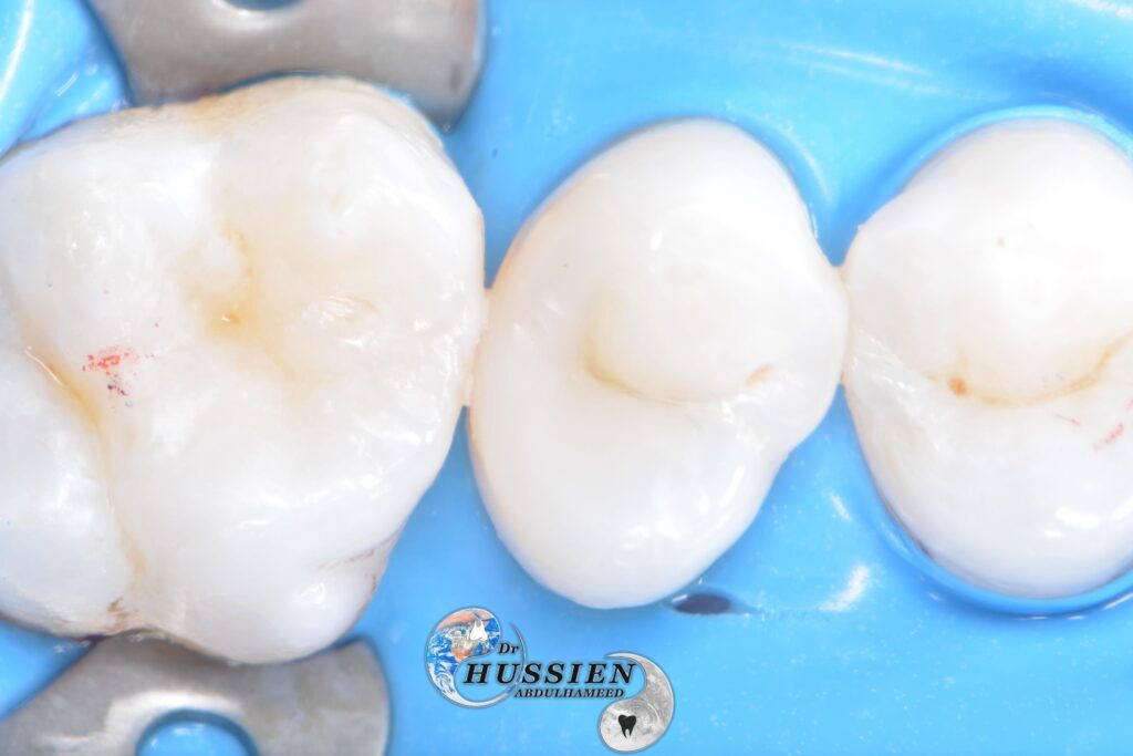 16F15F3E-2FC3-4ABA-A015-082390FCE222
