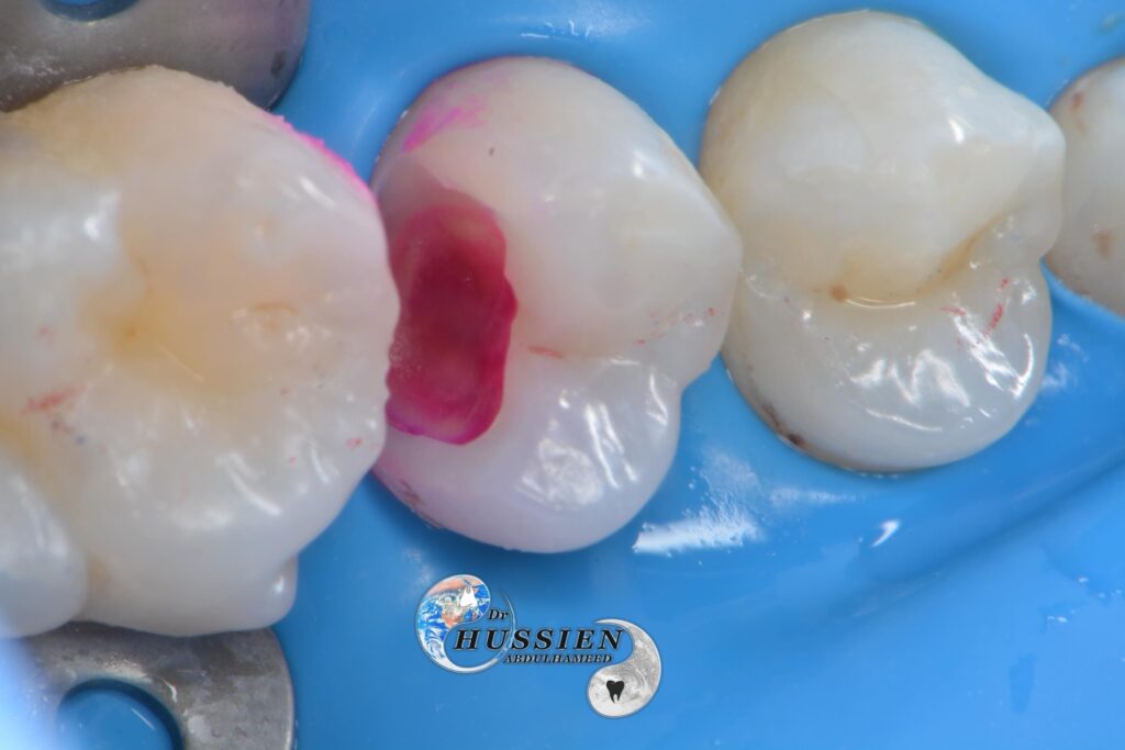 7350A40E-02C2-4571-9395-11BA71DA3E7B
