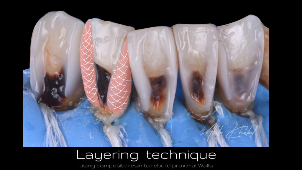 Layering  technique