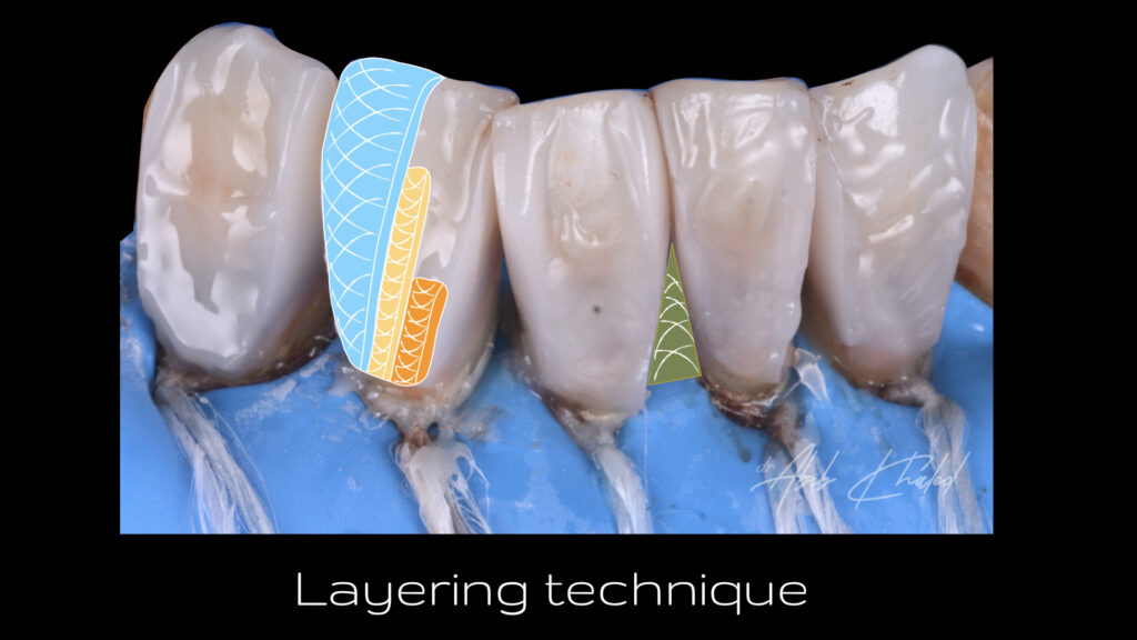 Layering technique