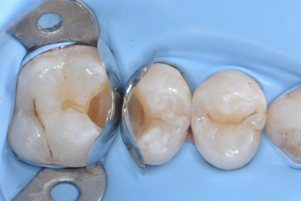 IMG_3554