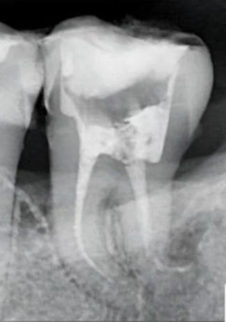 lower 8 anatomy