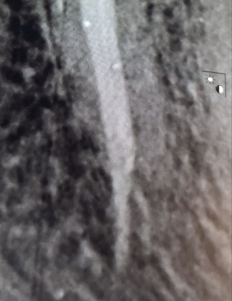 xray view