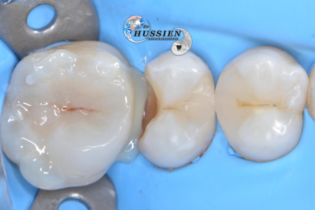 E3634CD3-9E20-4C9D-A49C-22BC690FA1FA