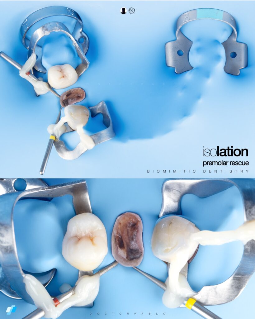 Before & Isolation