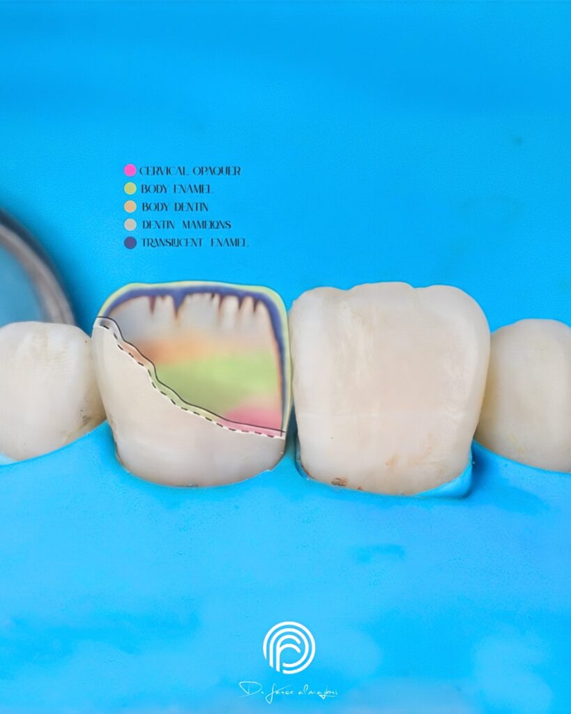 quality_restoration_20260811175844664