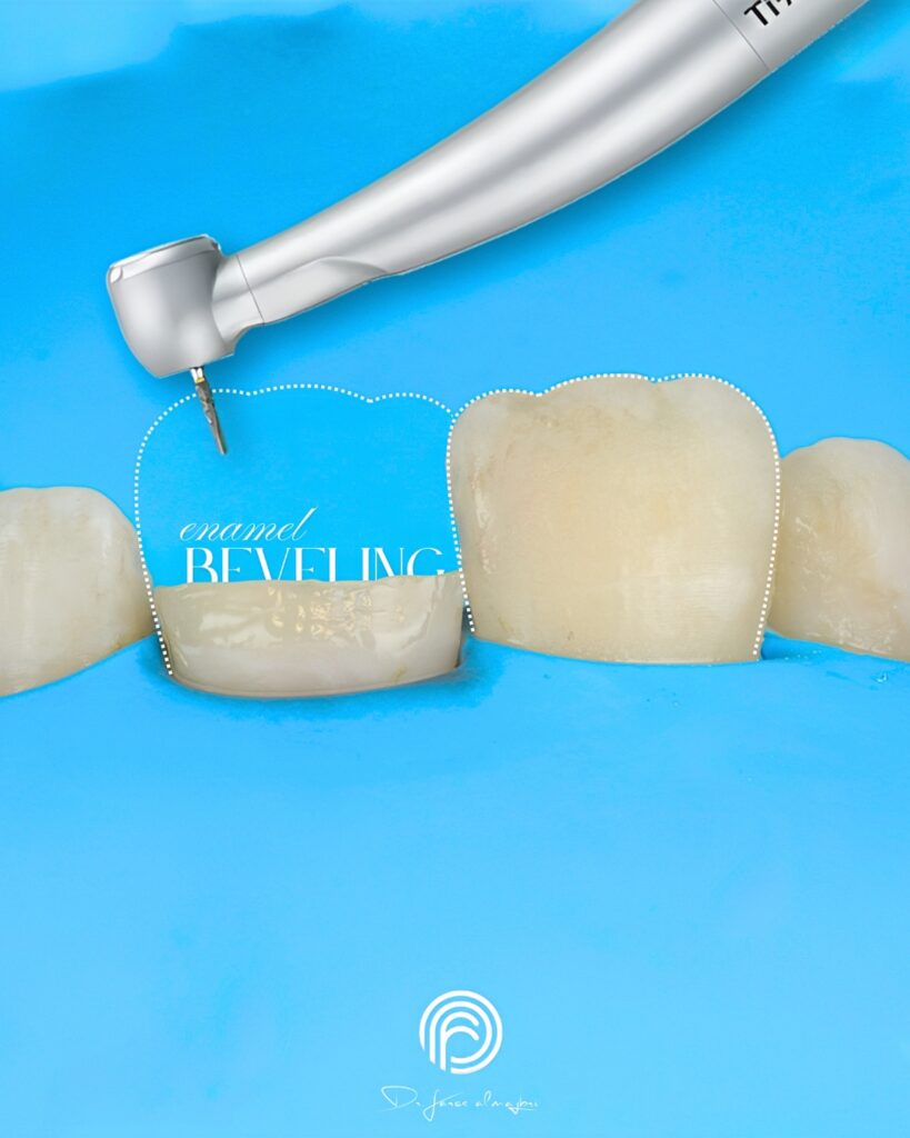quality_restoration_20260811175904222