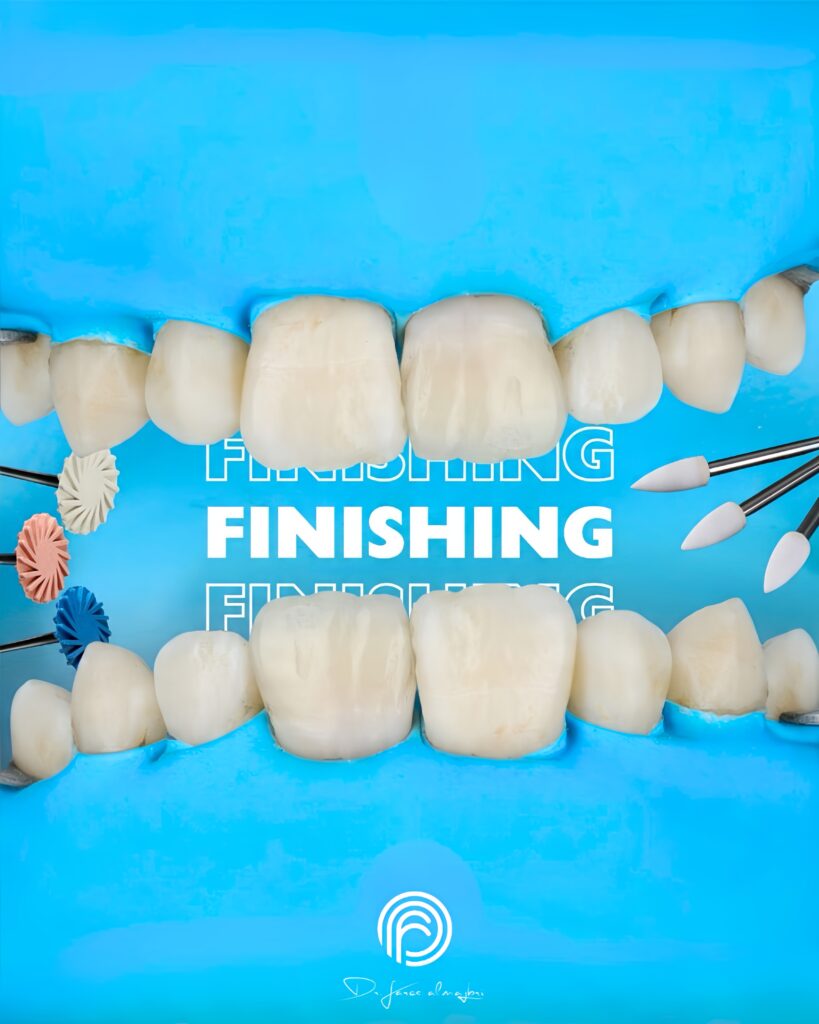 quality_restoration_20260811180021034