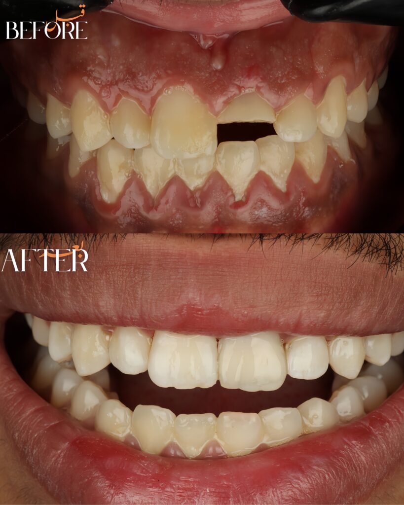 quality_restoration_20260811180046619