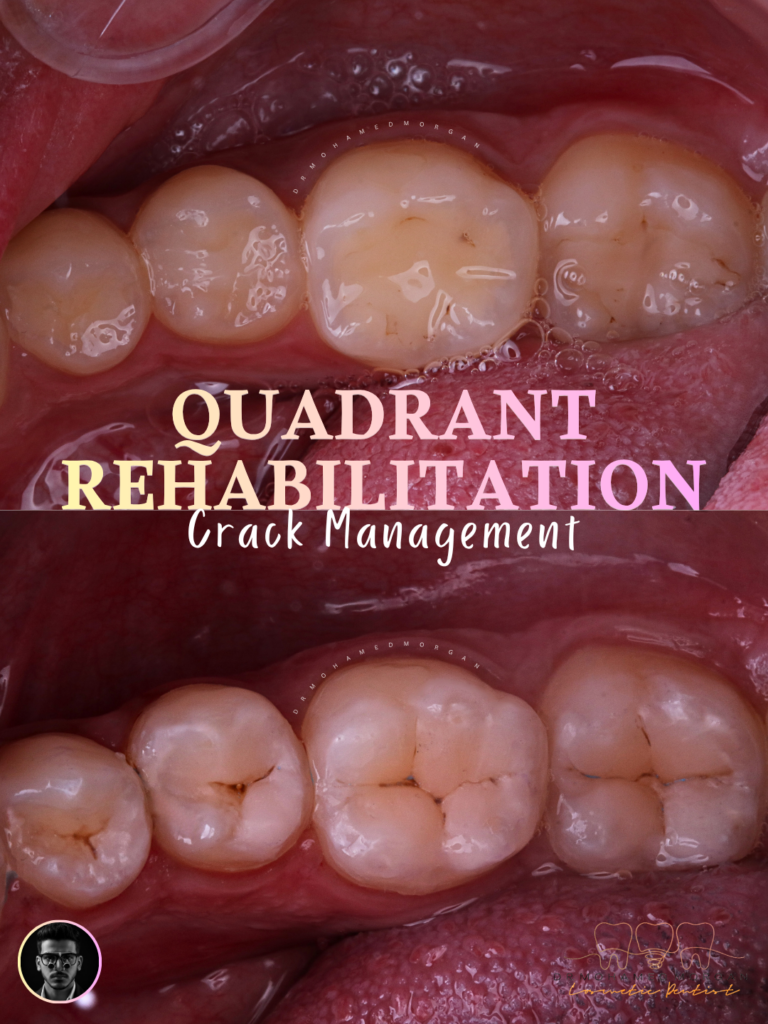 Quadrant Rehabilitation