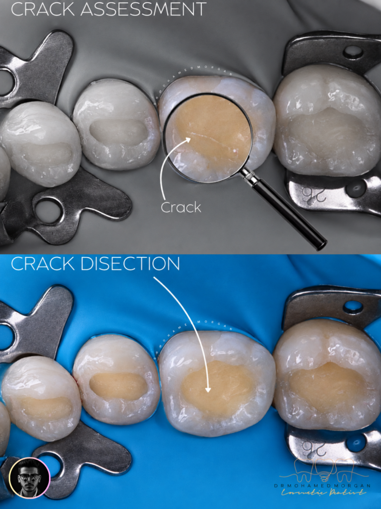 Crack Analysis