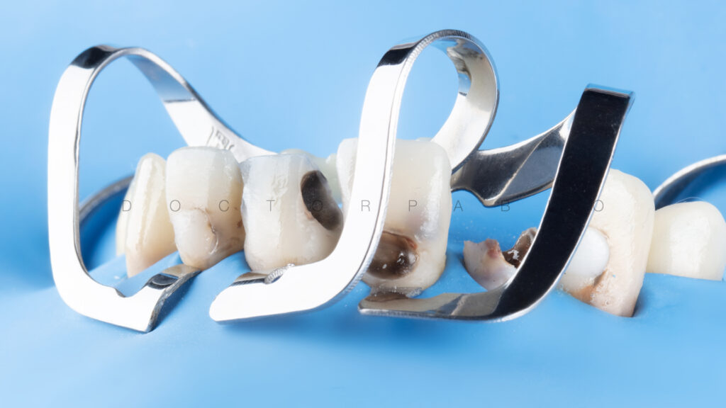 Anteior case MYZERO.008