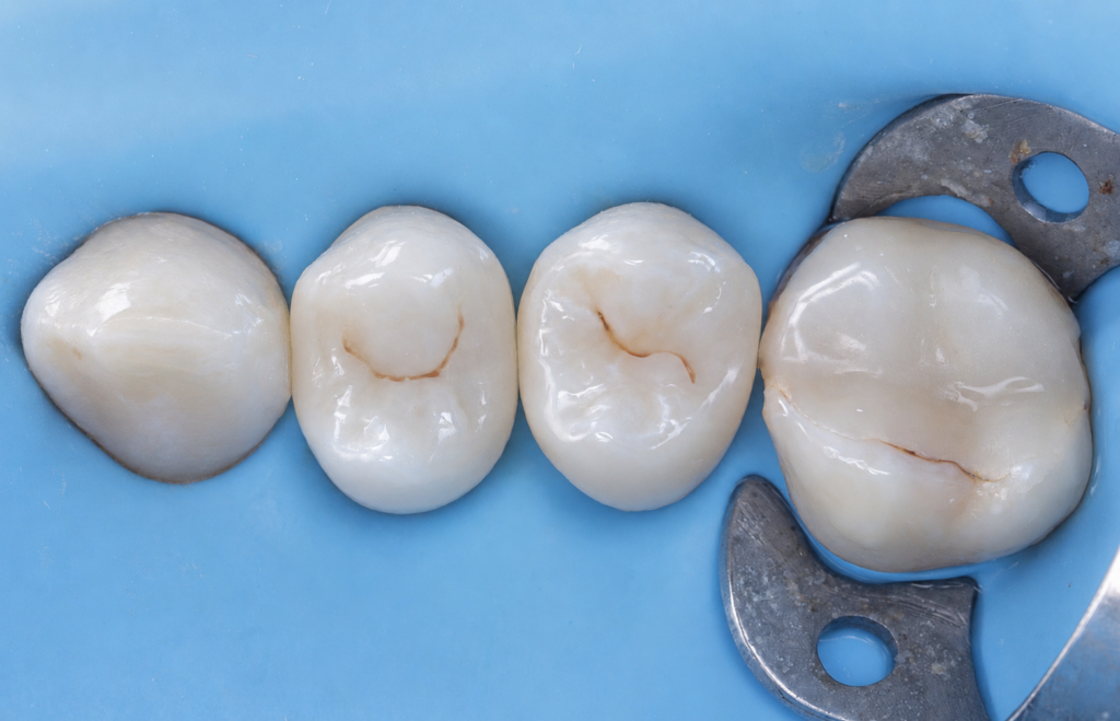 D287DEFD-014E-437F-BB11-C51CE00E1FBB