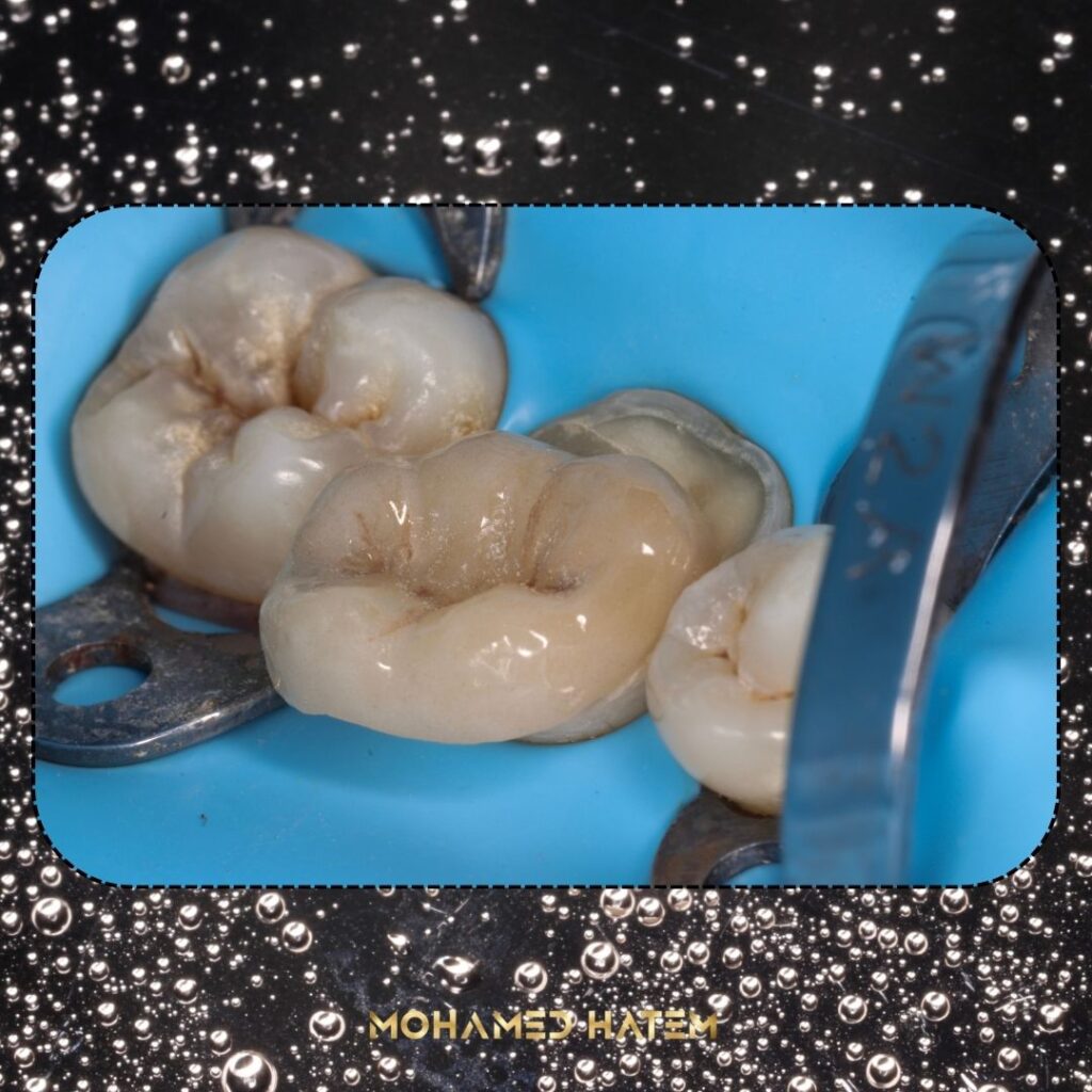 second post - 9