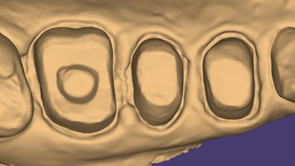 Screenshot_20251202_225210_exocad webview
