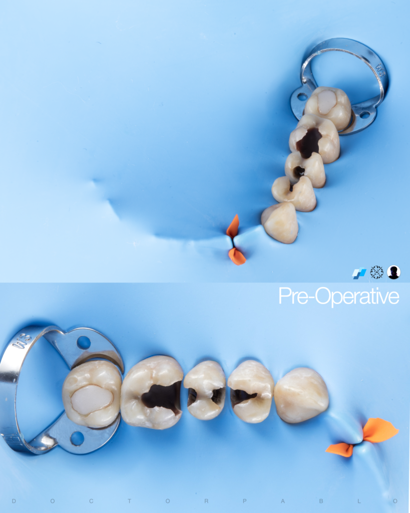 QUAD REHAB CASE.001