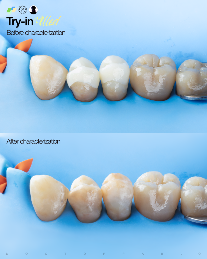 QUAD REHAB CASE.023